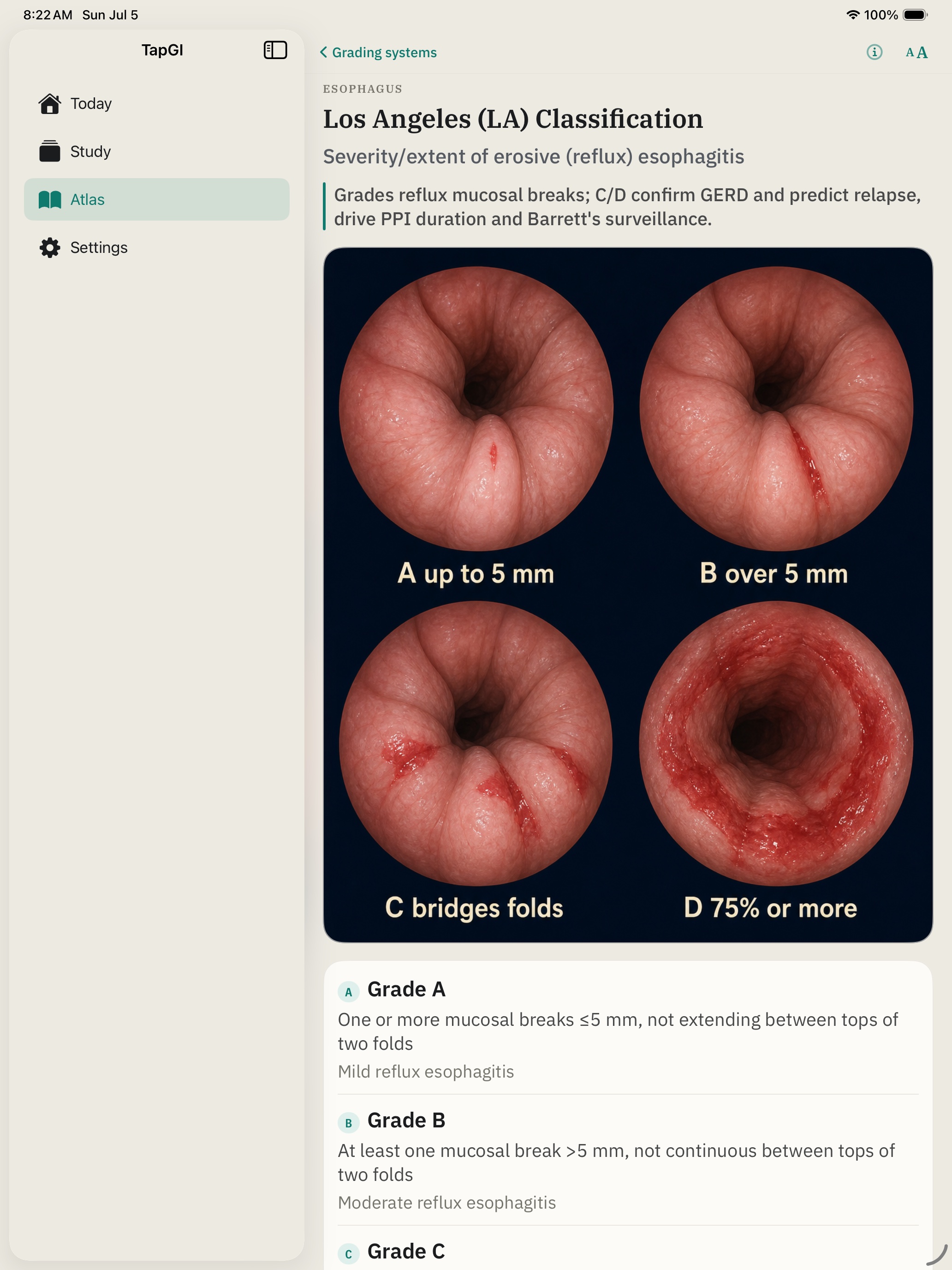TapGI Atlas showing image-based recognition and high-yield topics