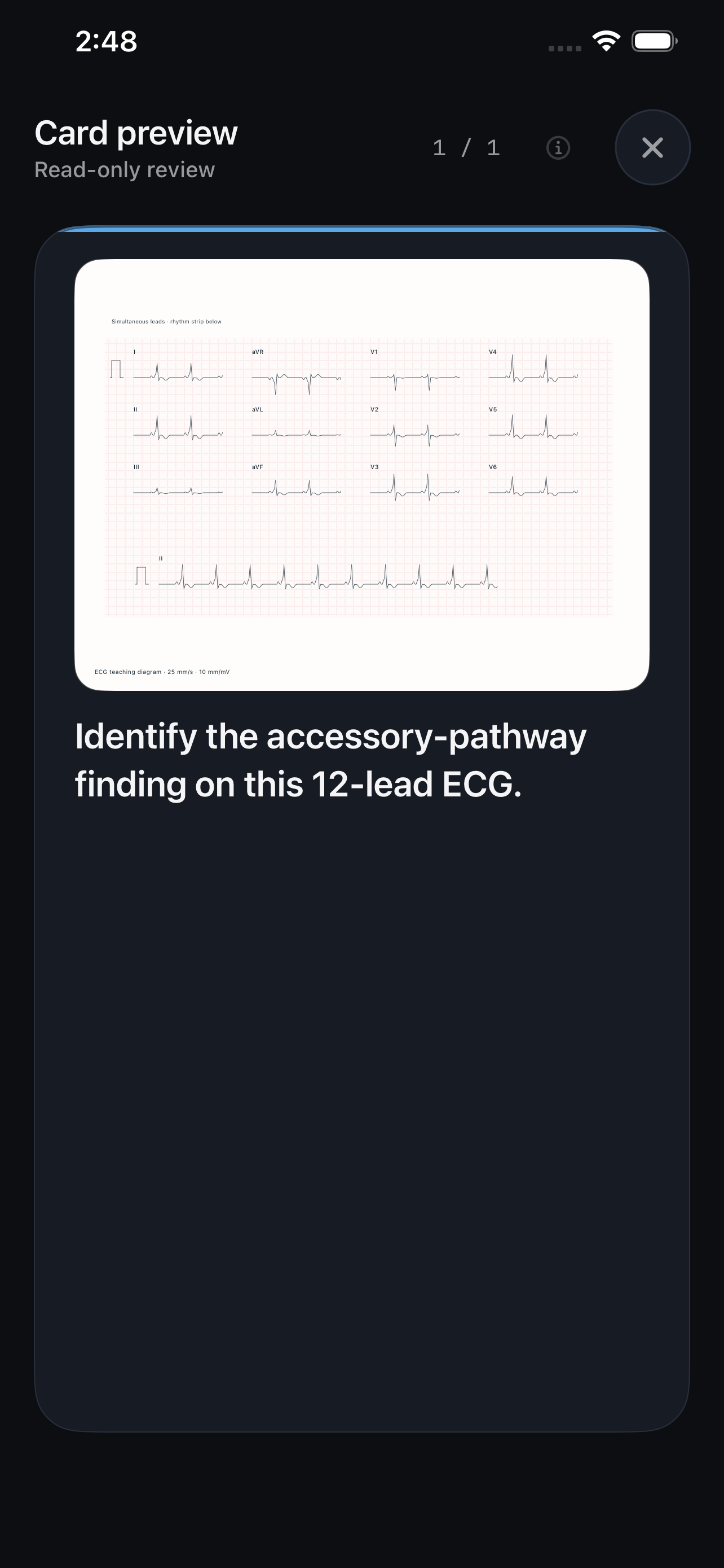 TapIM illustrated ECG review card