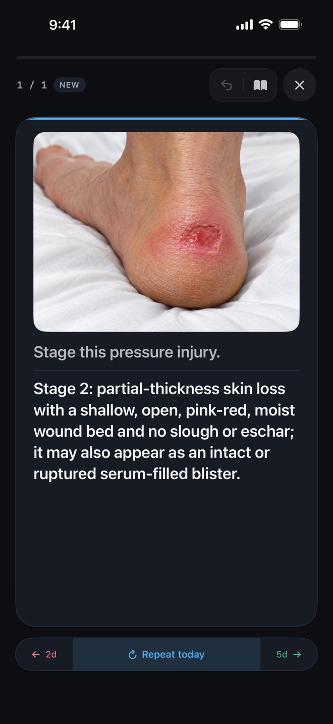 A pressure injury staging image card in TapRN